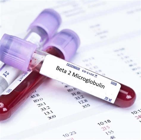 beta 2 microglobulin levels high